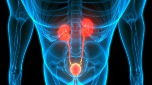 Early detection of prostate cancer is key to survival